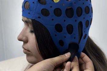 Los beneficios de la Terapia Transcraneal para combatir los dolores de cabeza